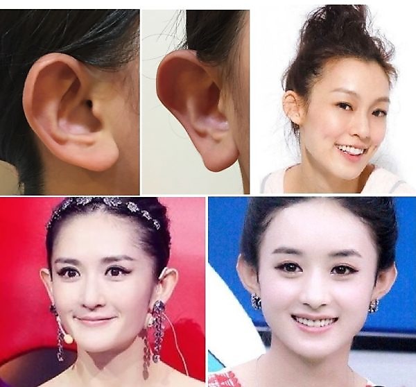 耳朵形狀,耳朵類型,耳朵類型搭配耳環,耳朵類型適合耳環,韓國耳環,夾式耳環